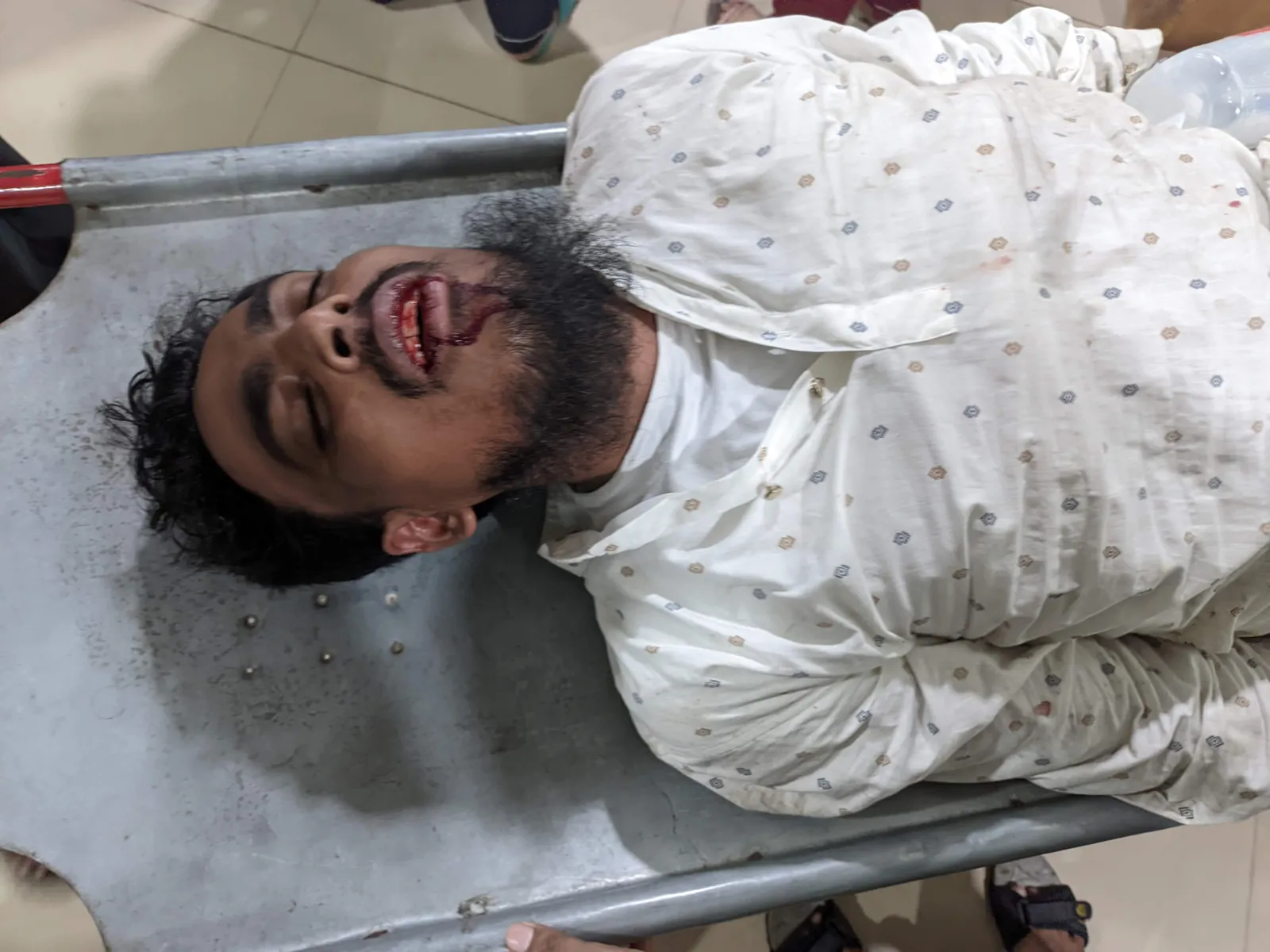 হামলায় আহত আখতার হোসেন